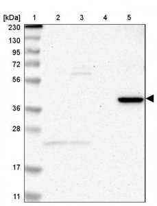 Anti-ZNF396 antibody produced in rabbit HPA006686-100UL