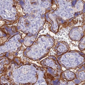 Anti-ZNF418 antibody produced in rabbit 