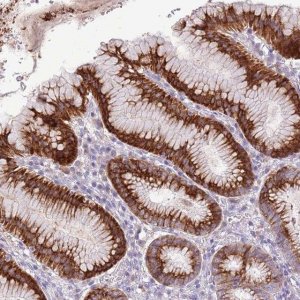 Anti-ZNF425 antibody produced in rabbit 