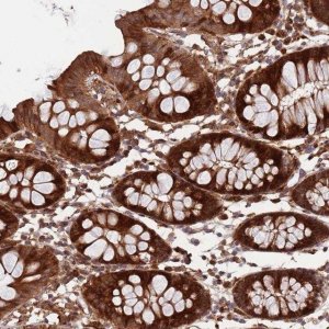 Anti-ZNF428 antibody produced in rabbit 