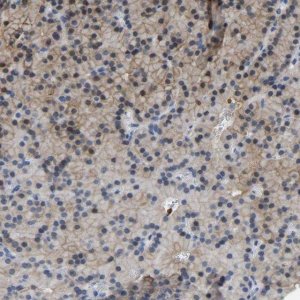 Anti-ZNF449 antibody produced in rabbit 