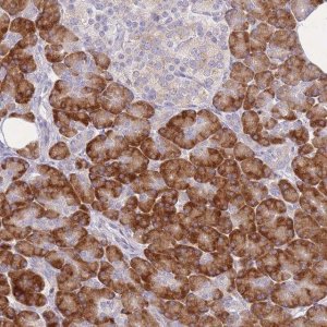 Anti-ZNF510 antibody produced in rabbit 