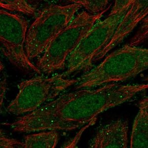 Anti-ZNF510 antibody produced in rabbit 