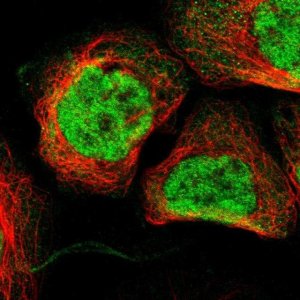 Anti-ZNF512B antibody produced in rabbit 