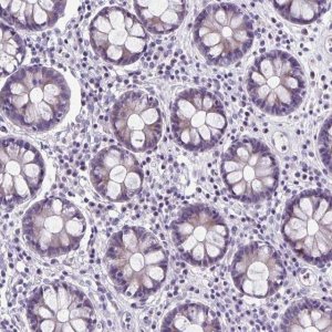 Anti-ZNF555 antibody produced in rabbit HPA053956-100UL