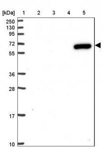 Anti-ZNF555 antibody produced in rabbit HPA053956-100UL