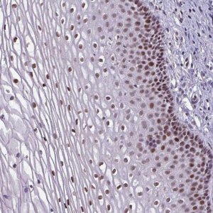 Anti-ZNF575 antibody produced in rabbit 