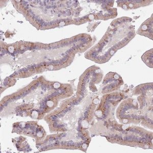 Anti-ZNF576 antibody produced in rabbit 