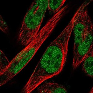 Anti-ZNF594 antibody produced in rabbit 