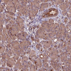 Anti-ZNF598 antibody produced in rabbit 
