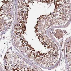 Anti-ZNF624 antibody produced in rabbit 