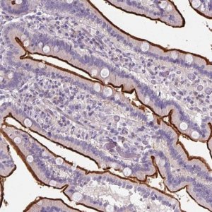 Anti-ZNF648 antibody produced in rabbit 