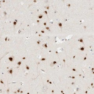 Anti-ZNF683 antibody produced in rabbit 