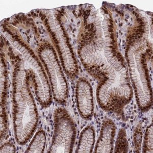 Anti-ZNF707 antibody produced in rabbit 
