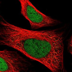 Anti-ZNF707 antibody produced in rabbit 
