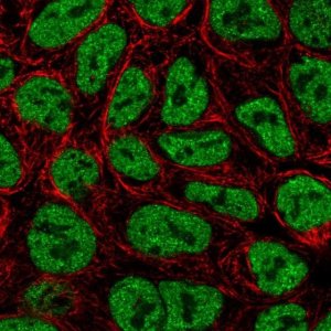 Anti-ZNF709 antibody produced in rabbit 