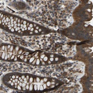 Anti-ZNF71 antibody produced in rabbit 
