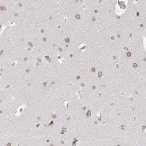 Anti-ZNF770 antibody produced in rabbit 