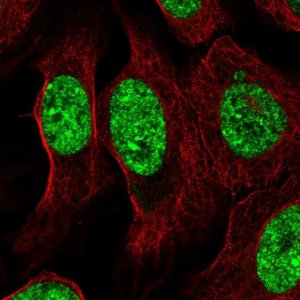 Anti-ZNF786 antibody produced in rabbit HPA053459-100UL