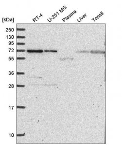 Anti-ZNF786 antibody produced in rabbit HPA053459-100UL
