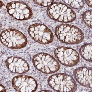 Anti-ZNF791 antibody produced in rabbit 