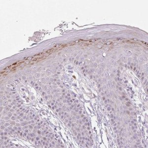 Anti-ZNF814 antibody produced in rabbit 