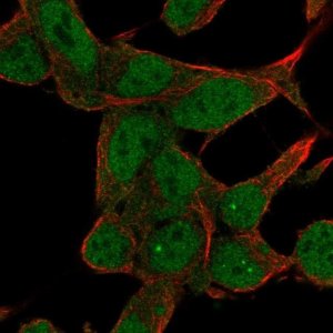 Anti-ZNF829 antibody produced in rabbit 