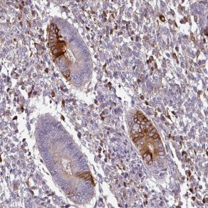 Anti-ZNF835 antibody produced in rabbit 