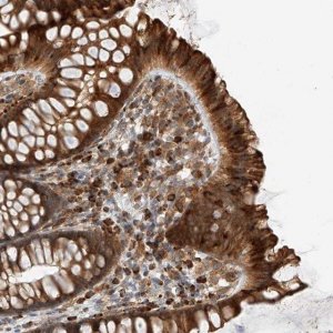 Anti-ZNF84 antibody produced in rabbit 