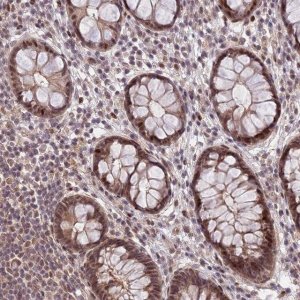 Anti-ZNF85 antibody produced in rabbit 