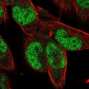 Anti-ZNF85 antibody produced in rabbit 
