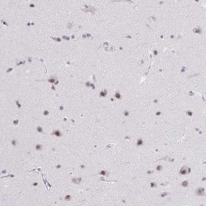 Anti-ZNF860 antibody produced in rabbit 