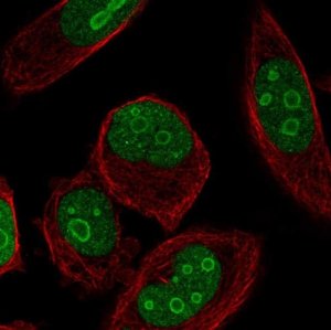 Anti-ZNF860 antibody produced in rabbit 