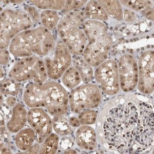 Anti-ZSCAN21 antibody produced in rabbit 