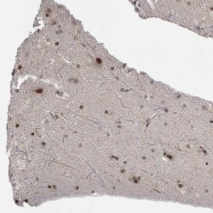 Anti-ZSCAN21 antibody produced in rabbit 