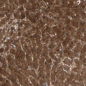 Anti-ZSCAN31 antibody produced in rabbit 
