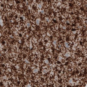 Monoclonal Anti-CNP antibody produced in mouse 