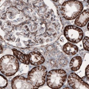 Monoclonal Anti-CTNNB1 antibody produced in mouse 
