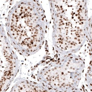 Monoclonal Anti-HIST1H2AG antibody produced in mouse 