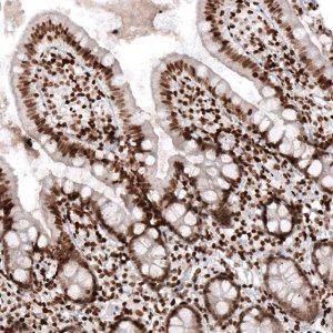 Monoclonal Anti-HIST1H2AG antibody produced in mouse 
