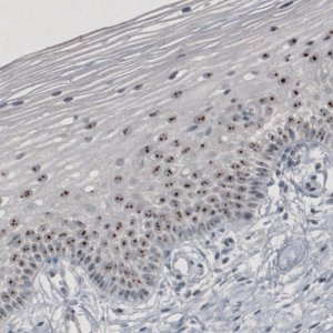 Monoclonal Anti-MKI67IP antibody produced in mouse 