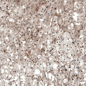 Monoclonal Anti-NR5A1 antibody produced in mouse AMAB91540-100UL