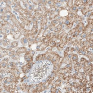 Monoclonal Anti-SDHB antibody produced in mouse 