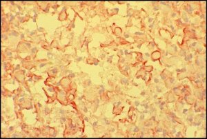 Anti-Mouse IgM (-chain specific)�Peroxidase antibody produced in goat 