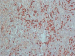 Anti-Rat IgG (whole molecule)Peroxidase antibody produced in rabbit A9542-2ML