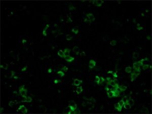 Monoclonal Anti-Rat Kappa & Lambda Light ChainsFITC antibody produced in mouse 