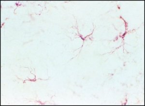 Mouse ExtrAvidin� Peroxidase Staining Kit antibody produced in goat EXTRA2-1KT