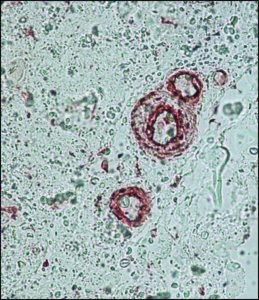 Anti--Actin antibody, Mouse monoclonal 