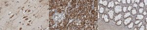 Anti-60S Ribosomal Protein L26 