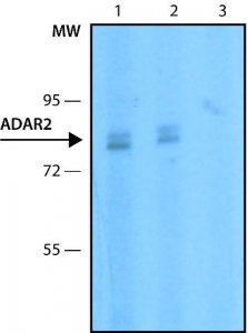 Anti-ADAR2 antibody, Mouse monoclonal 